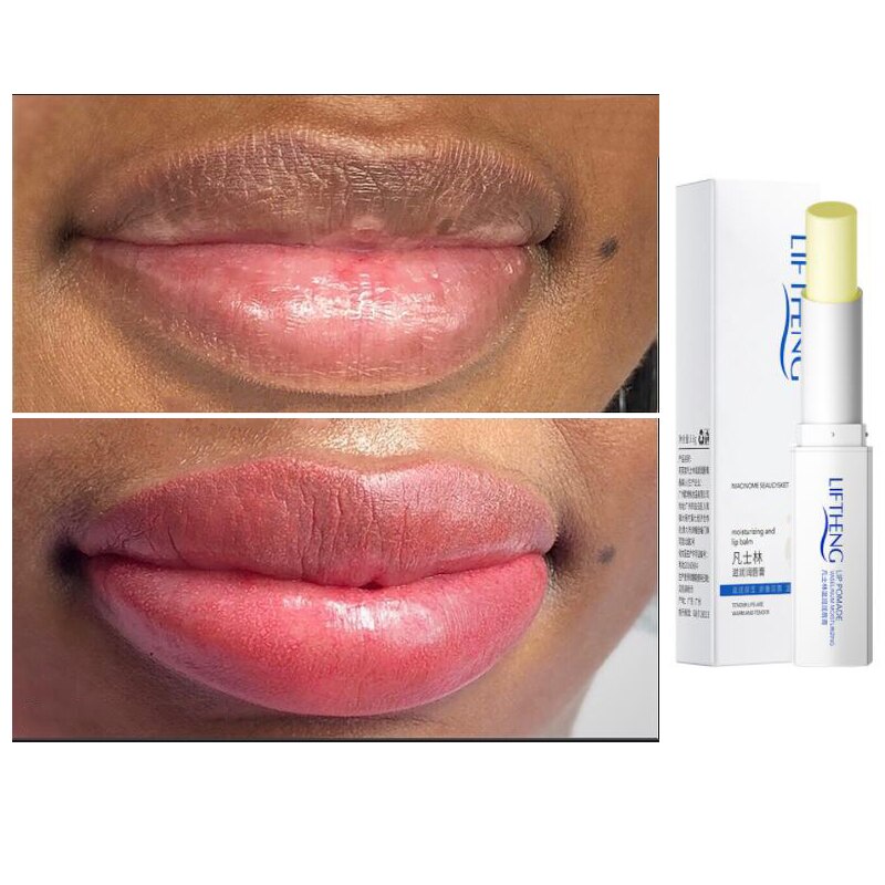 Efficient Lip Lightening Scrub Balm Remove Dull Lips Moisturizing Anti-Aging Anti-Cracking Hyaluronic Acid Brighten Black Lip